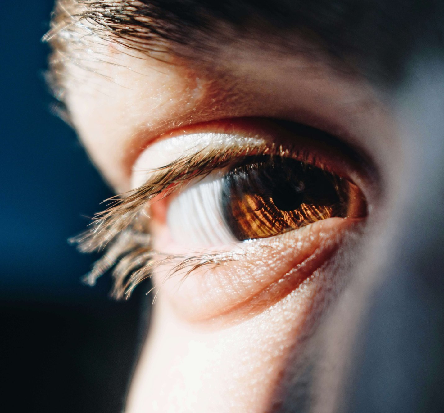 Lens replacement surgery